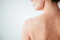 Dr Dermatologie Charlotte Lambrecht