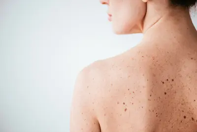 Dr Dermatologie Charlotte Lambrecht