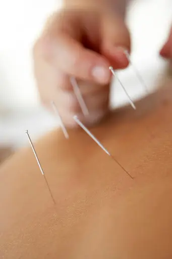 Katrien Van Damme - Balance. Acupunctuur & Kinesitherapie